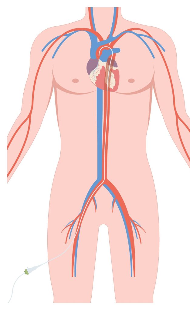 ANGIOGRAMS – Elite Diagnostic