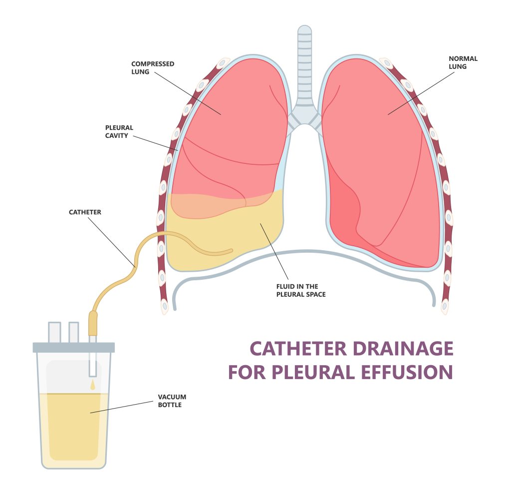 ASPIRATION & BIOPSY – Elite Diagnostic